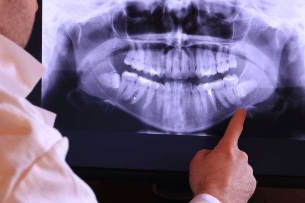 Best After-Hours Emergency Dentist in Chisago City, MN